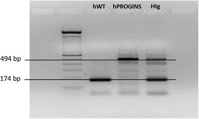 Mutations in the Progesterone Receptor (PROGINS) May Reduce the Symptoms of Acute Hepatitis E and Protect Against Infection